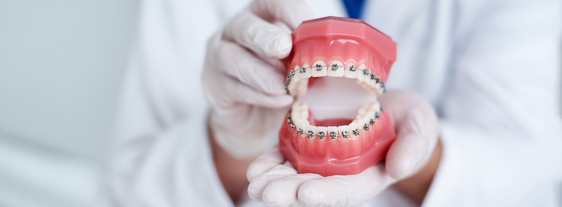 The image shows a dental model with an open mouth, held by a person wearing white gloves and a surgical mask.