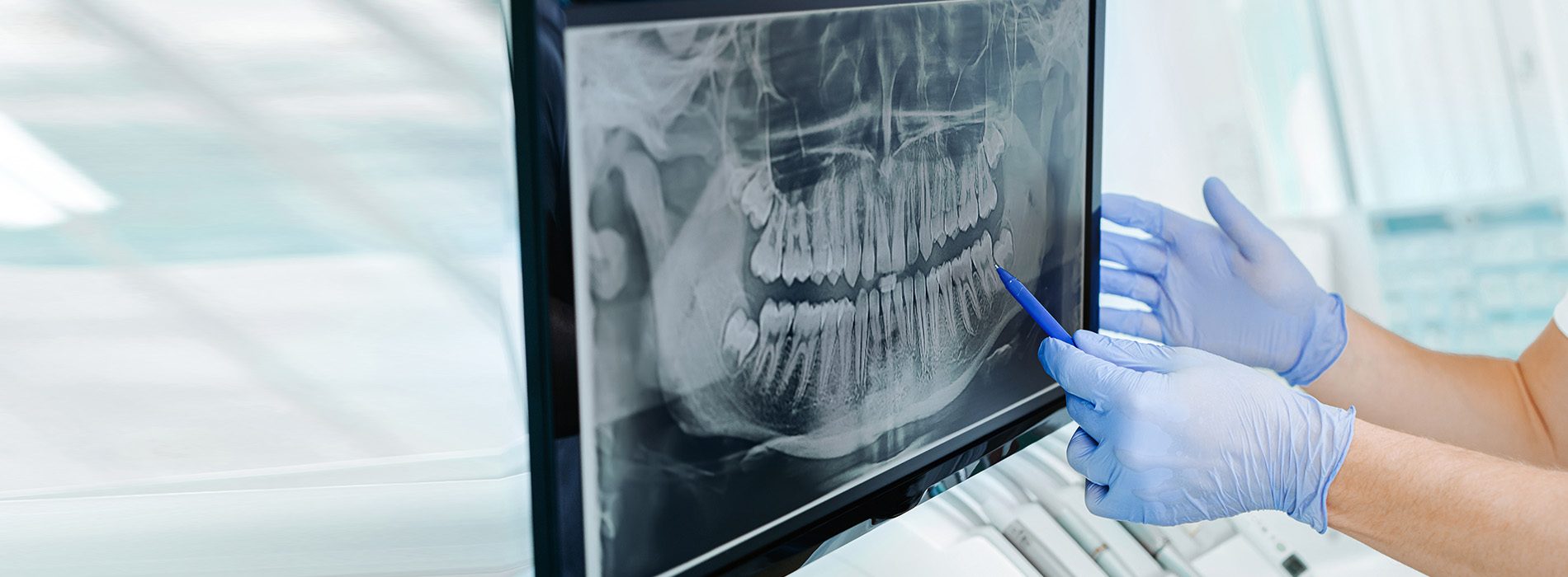 This is a color photograph showing a person in a medical setting, wearing gloves and using a computer with an open dental model displayed on the screen.